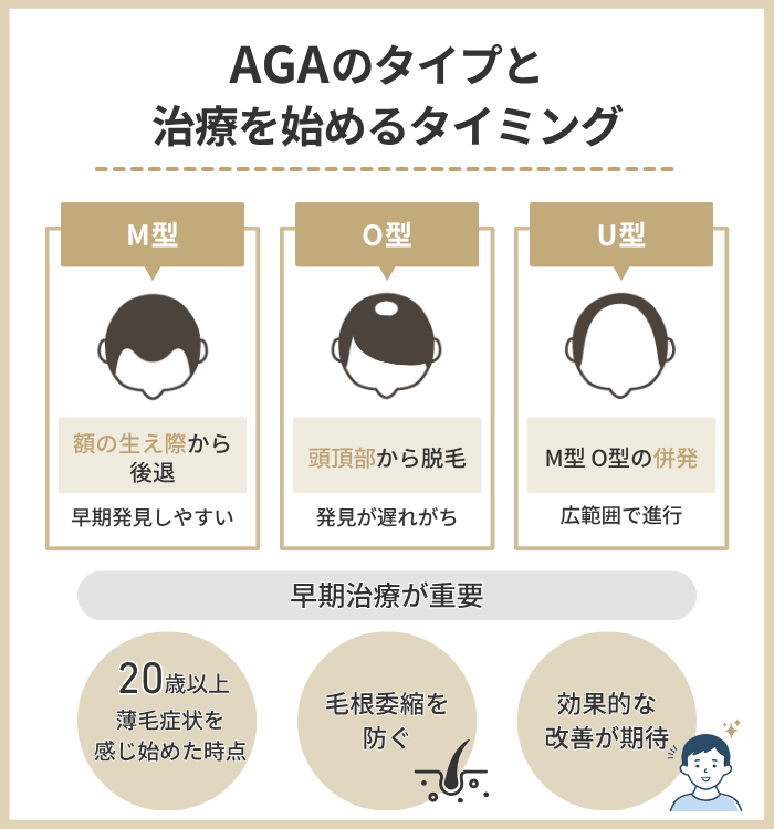 AGAのタイプと治療を始めるタイミング