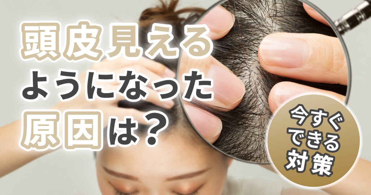 頭皮見えるようになった原因は？今すぐできる対策