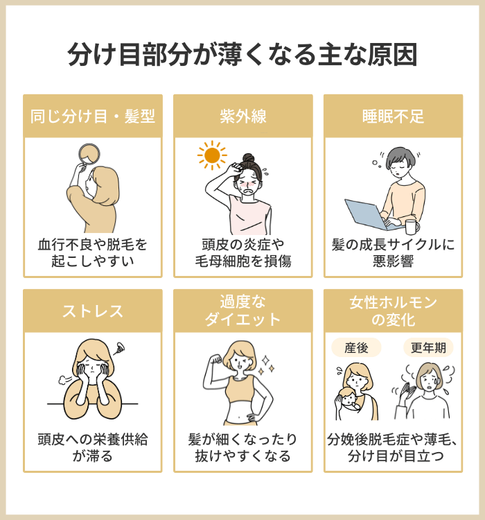 分け目部分が薄くなる主な原因