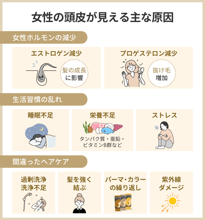女性の頭皮が見える主な原因